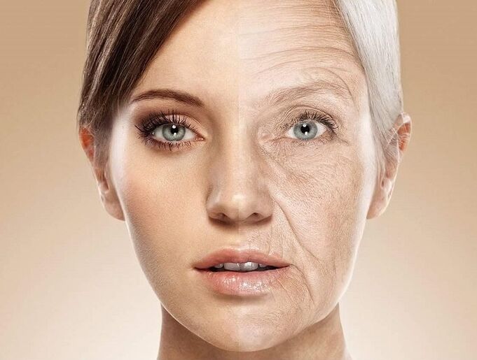 lazer gençleştirme öncesi ve sonrası yüz cildi